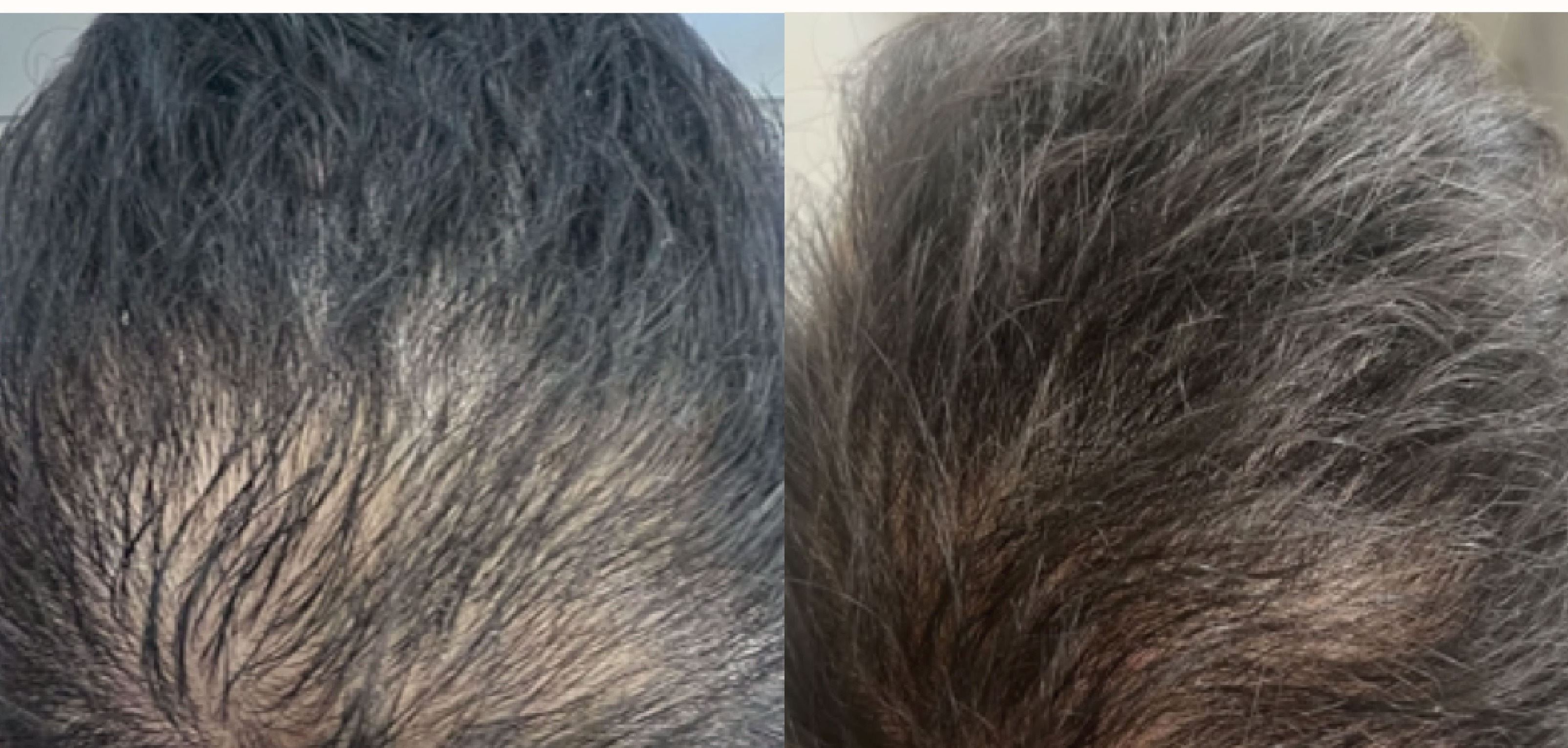 Scalp treatment results